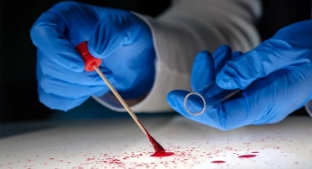 Goiás é lider nacional em análise de DNA forense